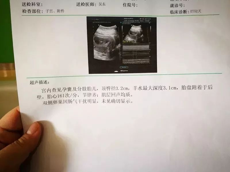 2B一切顺利，3B顺利毕业，转去私立医院产科建卡时也告知了医生肚子里的宝宝是试管宝宝